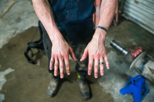 How to Prevent Dry, Cracked Hands at Work