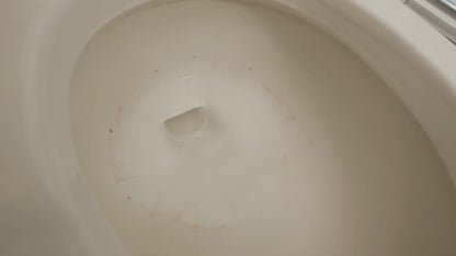 Zep Acidic Toilet Bowl Cleaner – Removes Hard Water Stains – 32 oz.